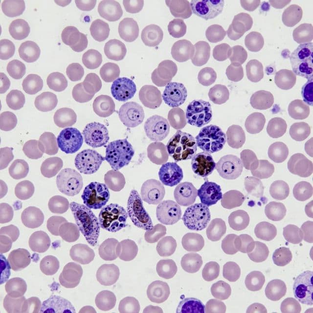 Raw Blood Smear